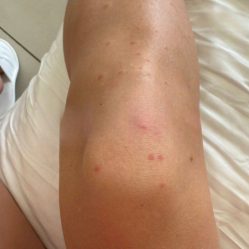 post-24454 thumbnail