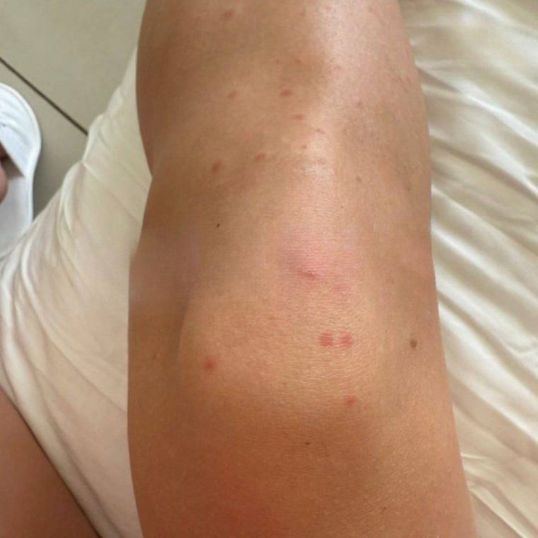 post-24454 thumbnail